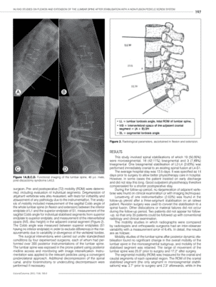 In vivo studies on flexion and extension of the lumbar spine after stabilisation with a non-fusion pedicle screw system