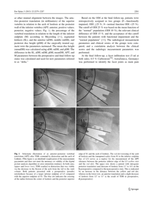 Parameters influencing the outcome after total disc replacement at the lumbosacral junction. Part 2